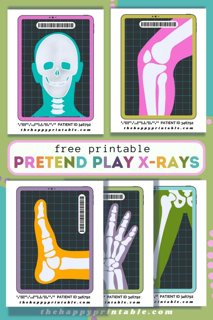 Printable X Rays For Kids